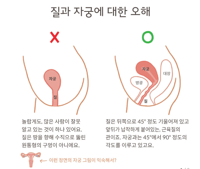 질의 크기는 어떻게 될까?